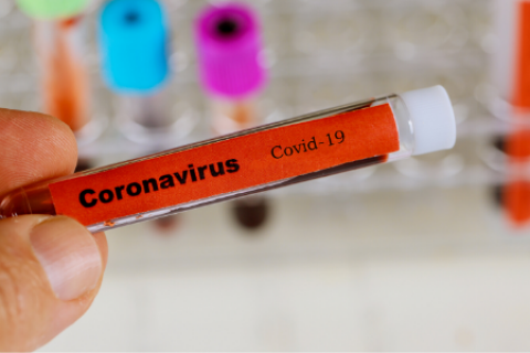 Coronavirus: se notificaron 24 nuevos casos en Gral Rodríguez