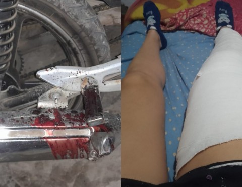 Más denuncias por imprudencias viales en General Rodríguez: peligrosa maniobra y una joven herida en Ruta 7