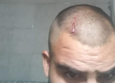 Terminó con un corte en la cabeza tras un violento asalto